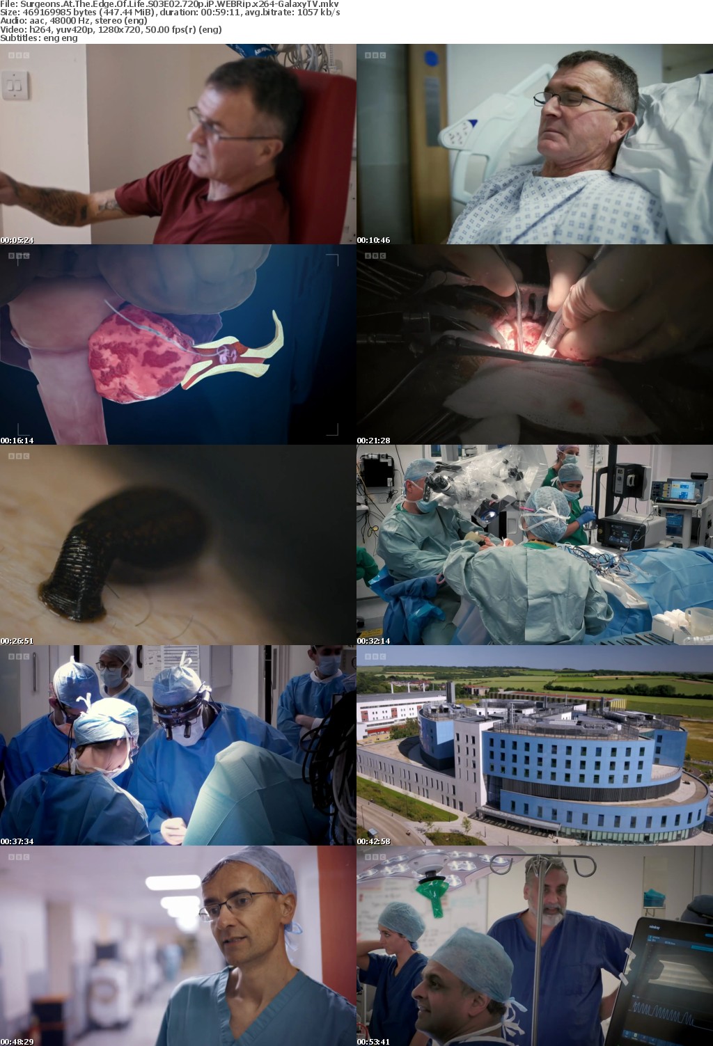 Surgeons At The Edge Of Life S03 COMPLETE 720p iP WEBRip x264-GalaxyTV